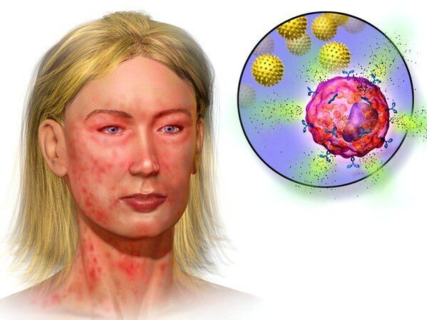 ehhinokokid ja nende kehas esinemise sümptomid